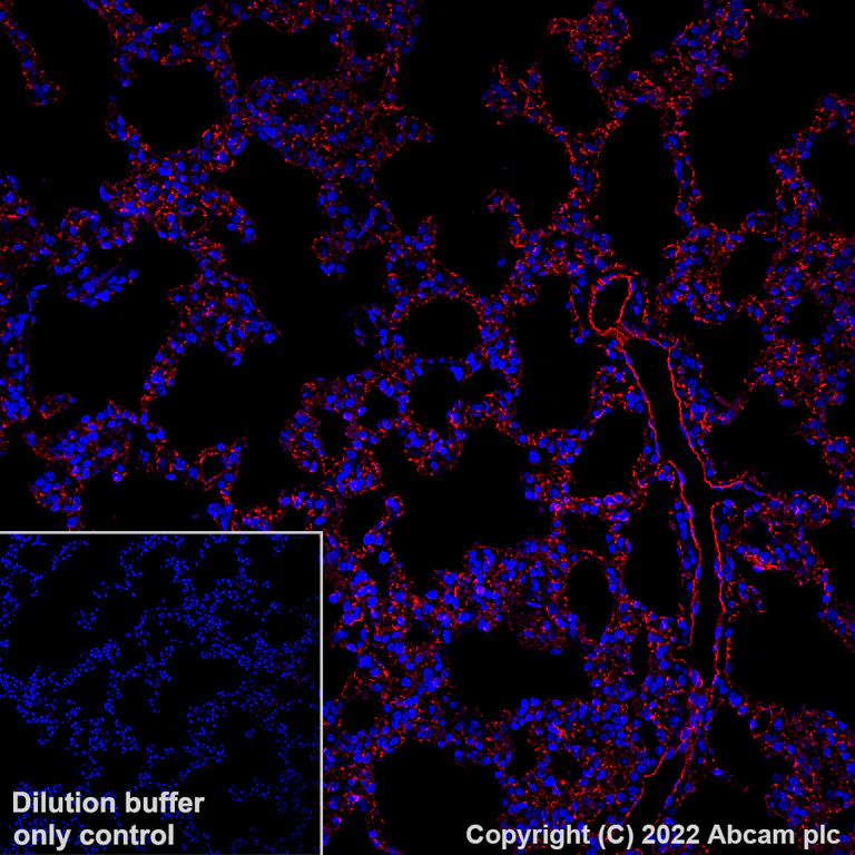 Immunohistochemistry (Formalin/PFA-fixed paraffin-embedded sections) - Alexa Fluor® 647 Anti-CD31 antibody [EPR17259] (AB305210)