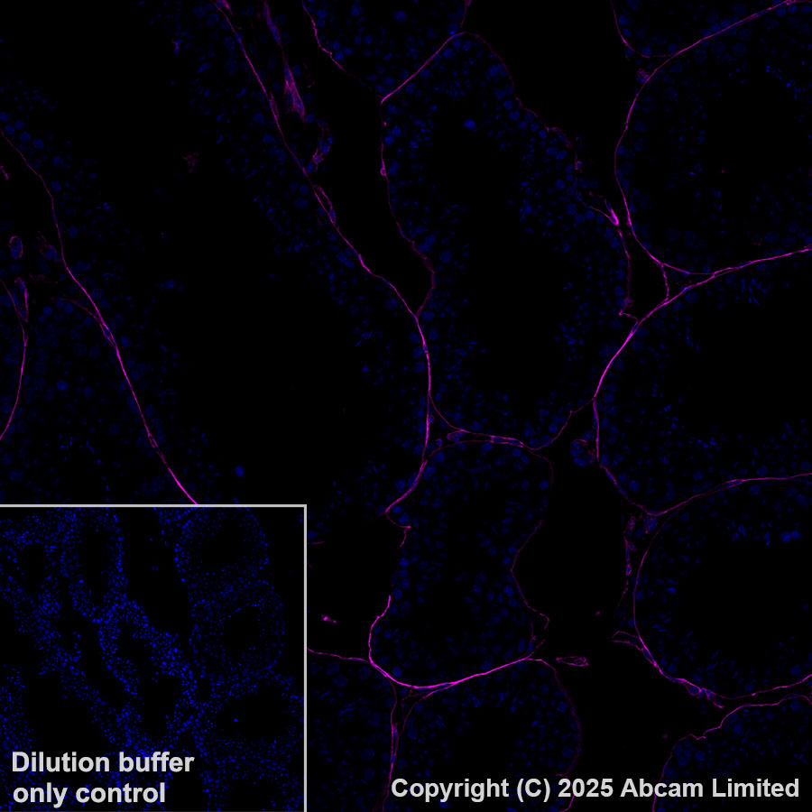Immunohistochemistry (Formalin/PFA-fixed paraffin-embedded sections) - Alexa Fluor® 647 Anti-CD34 antibody [EPR27431-71] (AB323893), expandable thumbnail