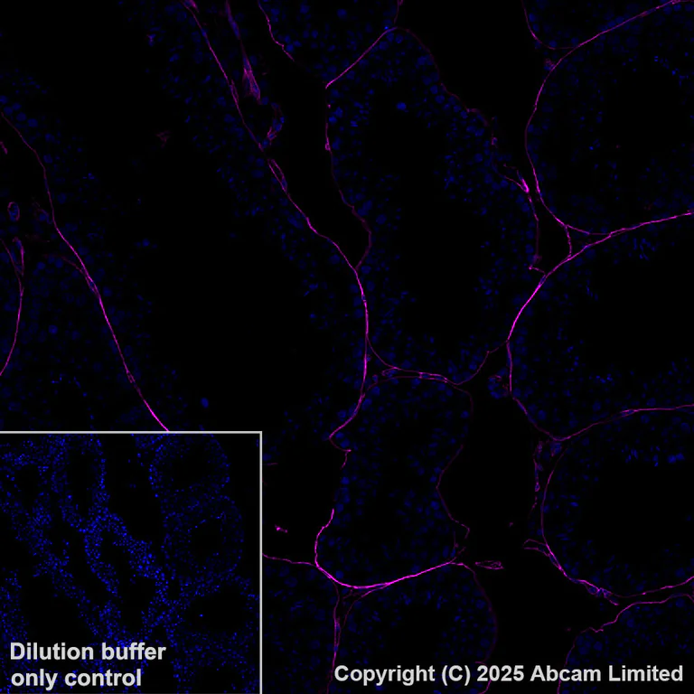 Immunohistochemistry (Formalin/PFA-fixed paraffin-embedded sections) - Alexa Fluor® 647 Anti-CD34 antibody [EPR27431-71] (AB323893)
