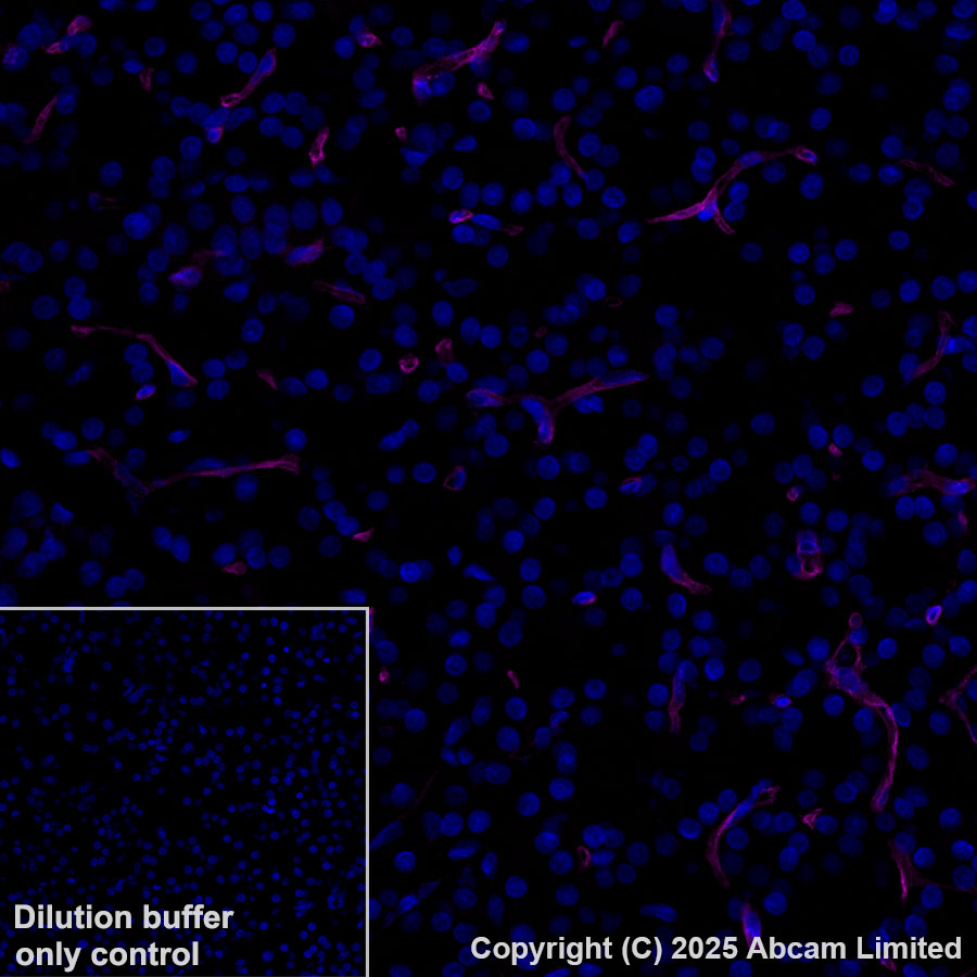 Immunohistochemistry (Formalin/PFA-fixed paraffin-embedded sections) - Alexa Fluor® 647 Anti-CD34 antibody [EPR27431-71] (AB323893), expandable thumbnail