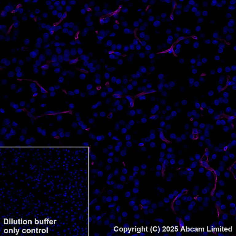 Immunohistochemistry (Formalin/PFA-fixed paraffin-embedded sections) - Alexa Fluor® 647 Anti-CD34 antibody [EPR27431-71] (AB323893)