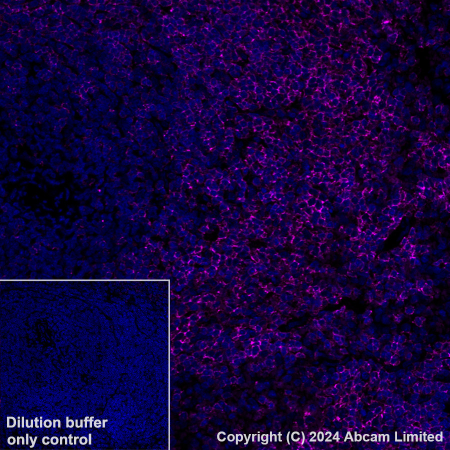 Immunohistochemistry (Formalin/PFA-fixed paraffin-embedded sections) - Alexa Fluor® 647 Anti-CD37 antibody [EPR28769-31] (AB323438), expandable thumbnail