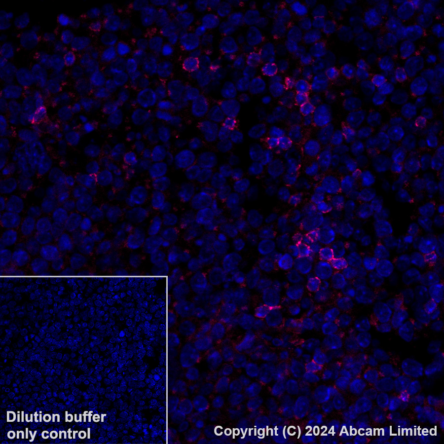 Immunohistochemistry (Formalin/PFA-fixed paraffin-embedded sections) - Alexa Fluor® 647 Anti-CD37 antibody [EPR28769-31] (AB323438), expandable thumbnail