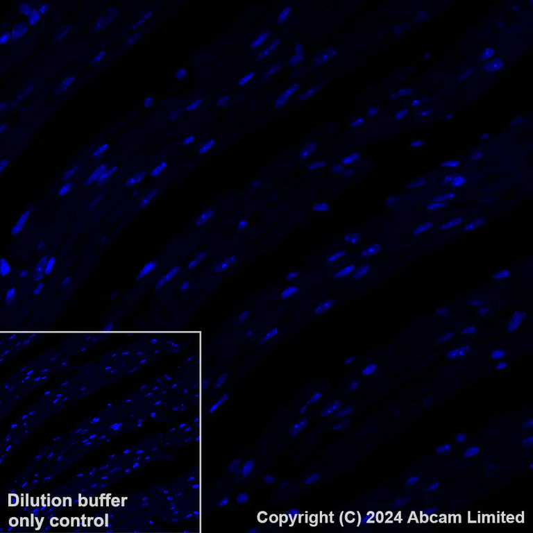 Immunohistochemistry (Formalin/PFA-fixed paraffin-embedded sections) - Alexa Fluor® 647 Anti-CD37 antibody [EPR28769-31] (AB323438)