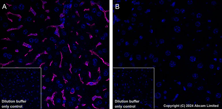 Immunohistochemistry (Formalin/PFA-fixed paraffin-embedded sections) - Alexa Fluor® 647 Anti-CD38 antibody [EPR21079] (AB320778)