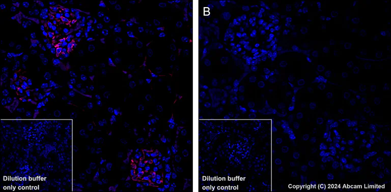 Immunohistochemistry (Formalin/PFA-fixed paraffin-embedded sections) - Alexa Fluor® 647 Anti-CD38 antibody [EPR21079] (AB320778)