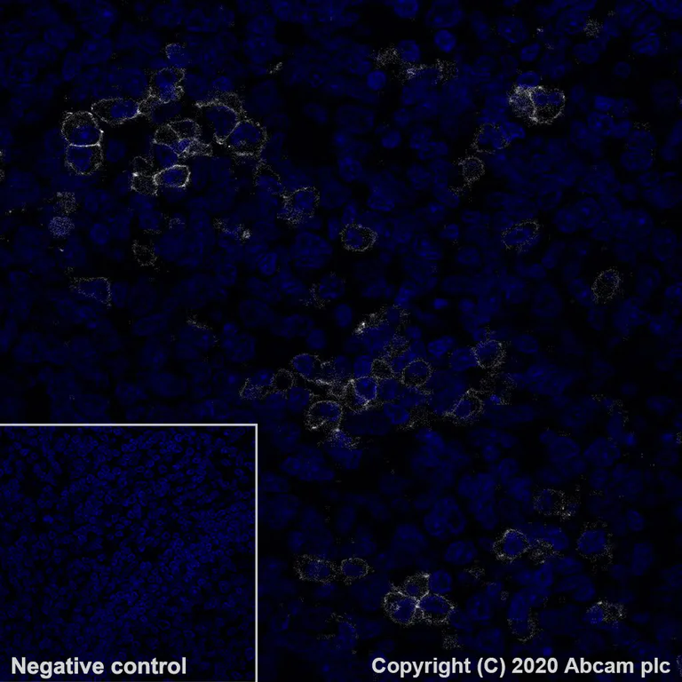 Immunohistochemistry (Formalin/PFA-fixed paraffin-embedded sections) - Alexa Fluor® 647 Anti-CD38 antibody [EPR4106] (AB279690)