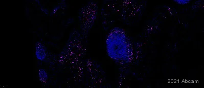 Immunohistochemistry (Formalin/PFA-fixed paraffin-embedded sections) - Alexa Fluor® 647 Anti-CD38 antibody [EPR4106] (AB279690)