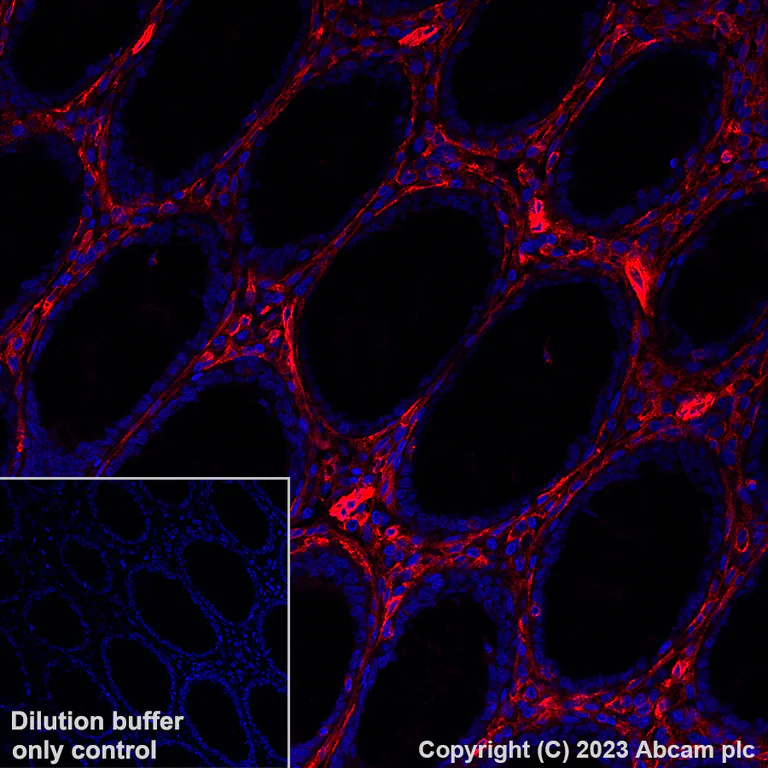 Immunohistochemistry (Formalin/PFA-fixed paraffin-embedded sections) - Alexa Fluor® 647 Anti-CD39 antibody [EPR20627] (AB312897)