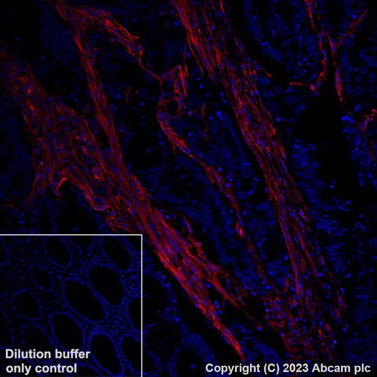 Immunohistochemistry (Formalin/PFA-fixed paraffin-embedded sections) - Alexa Fluor® 647 Anti-CD39 antibody [EPR20627] (AB312897)