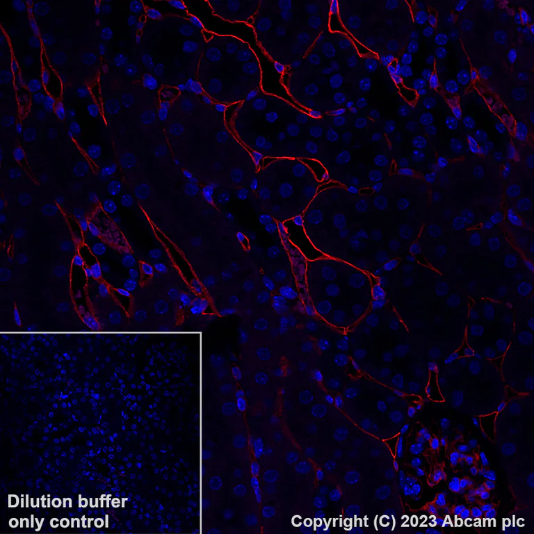 Immunohistochemistry (Formalin/PFA-fixed paraffin-embedded sections) - Alexa Fluor® 647 Anti-CD39 antibody [EPR20627] (AB312897)