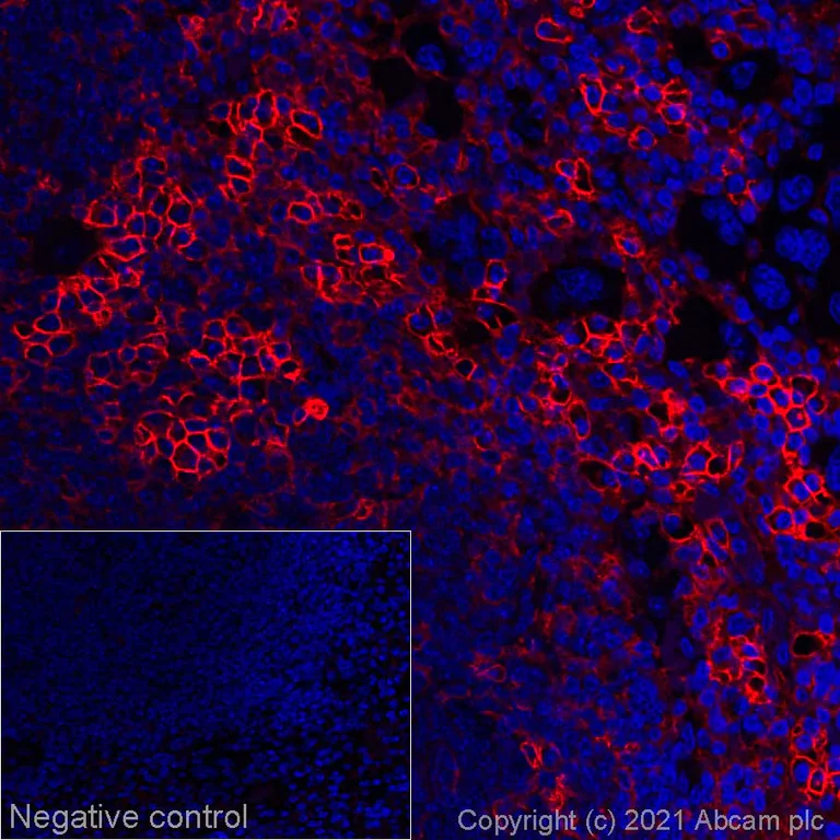 Immunohistochemistry (Formalin/PFA-fixed paraffin-embedded sections) - Alexa Fluor® 647 Anti-CD39 antibody [EPR22507-48] (AB270917)