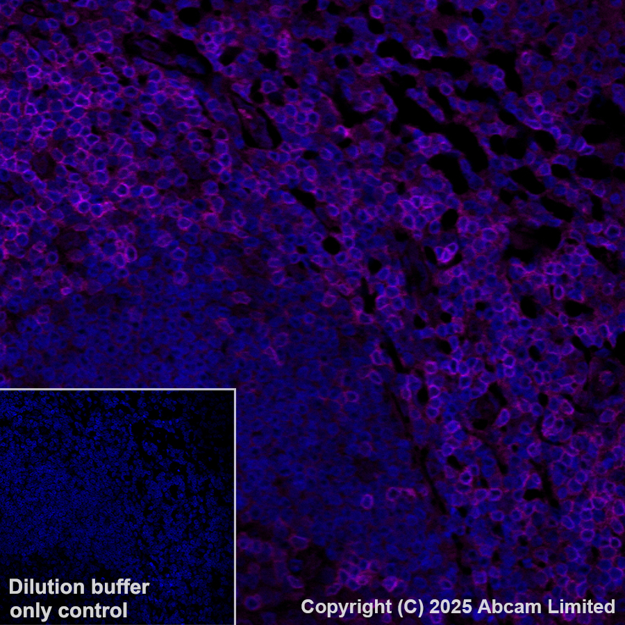 Immunohistochemistry (Formalin/PFA-fixed paraffin-embedded sections) - Alexa Fluor® 647 Anti-CD3D antibody [EP4426] (AB198937)