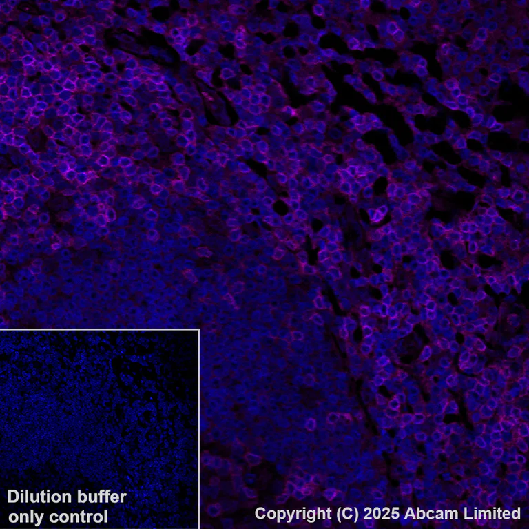 Immunohistochemistry (Formalin/PFA-fixed paraffin-embedded sections) - Alexa Fluor® 647 Anti-CD3D antibody [EP4426] (AB198937)
