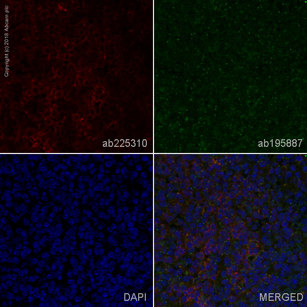 Immunohistochemistry (Frozen sections) - Alexa Fluor® 647 Anti-CD4 antibody [EPR19514] (AB225310)