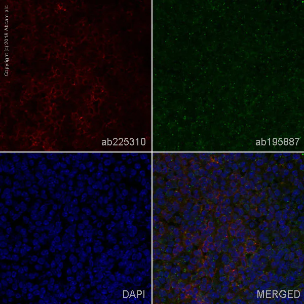 Immunohistochemistry (Frozen sections) - Alexa Fluor® 647 Anti-CD4 antibody [EPR19514] (AB225310)