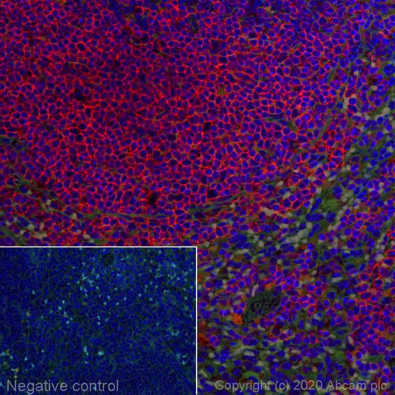 Immunohistochemistry (Formalin/PFA-fixed paraffin-embedded sections) - Alexa Fluor® 647 Anti-CD40 antibody [EPR23890-151] (AB275158)