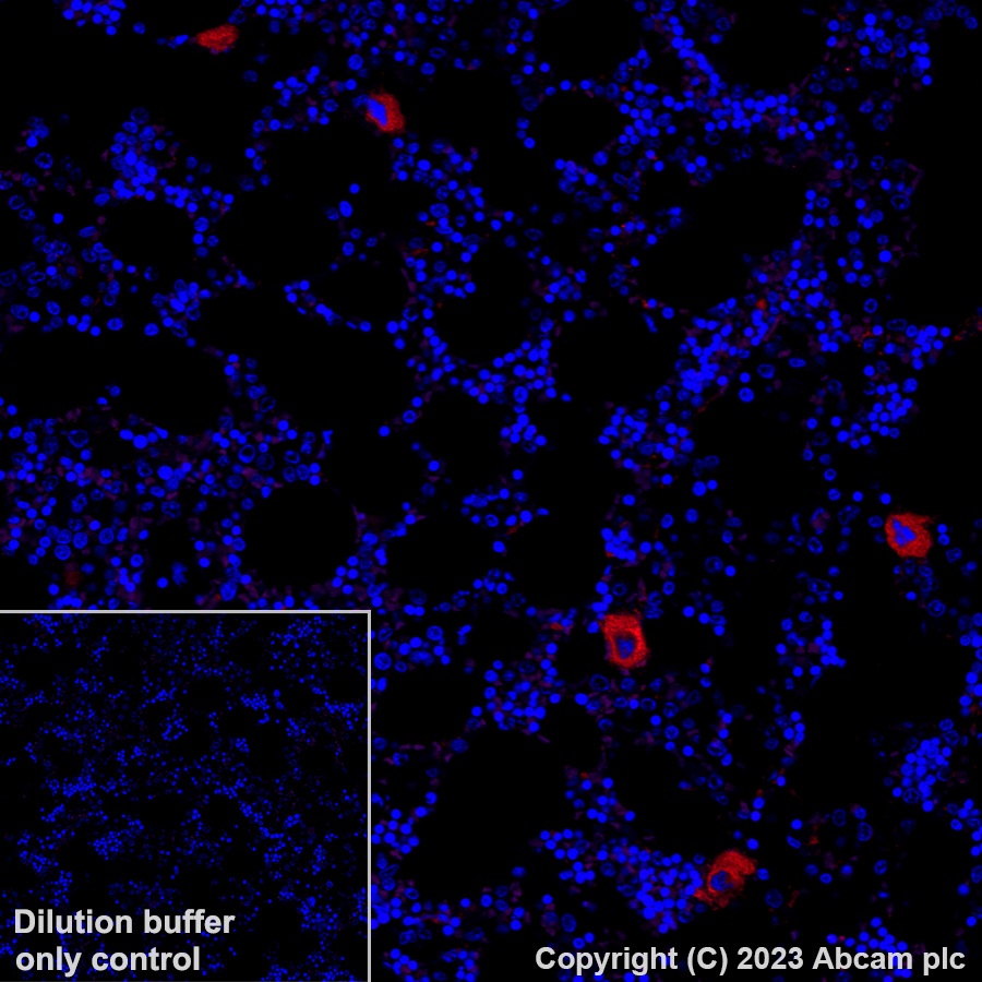 Alexa Fluor® 647 Anti-CD41 antibody [EPR4330] (ab308537) | Abcam