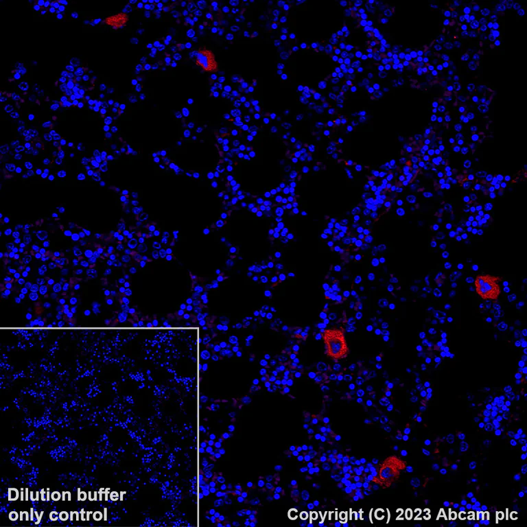 Immunohistochemistry (Formalin/PFA-fixed paraffin-embedded sections) - Alexa Fluor® 647 Anti-CD41 antibody [EPR4330] (AB308537)