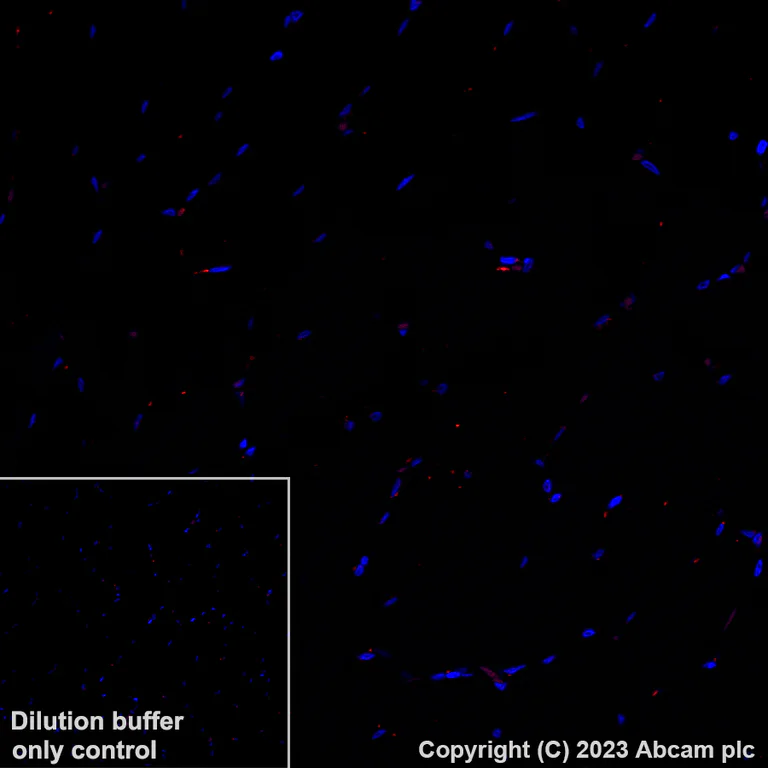 Immunohistochemistry (Formalin/PFA-fixed paraffin-embedded sections) - Alexa Fluor® 647 Anti-CD41 antibody [EPR4330] (AB308537)