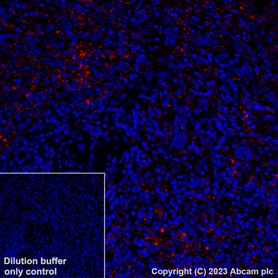 Alexa Fluor® 647 Anti-CD41 antibody [EPR4330] (ab308537) | Abcam