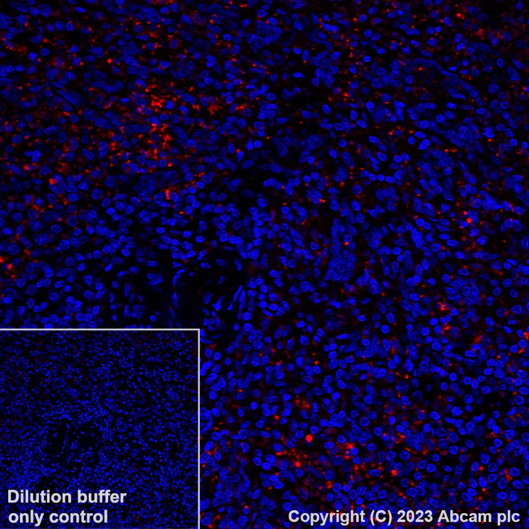Immunohistochemistry (Formalin/PFA-fixed paraffin-embedded sections) - Alexa Fluor® 647 Anti-CD41 antibody [EPR4330] (AB308537)
