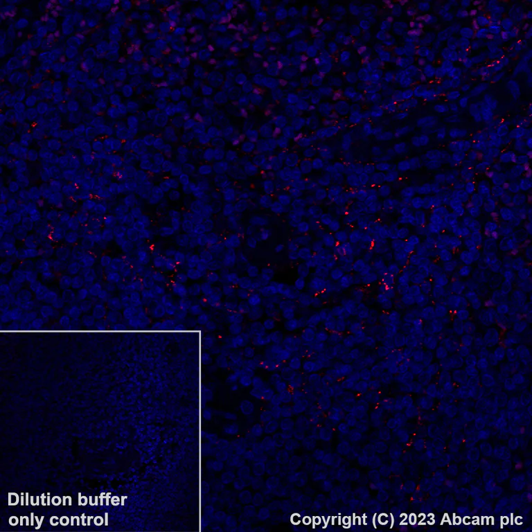 Immunohistochemistry (Formalin/PFA-fixed paraffin-embedded sections) - Alexa Fluor® 647 Anti-CD42b antibody [EPR6995] (AB313595)
