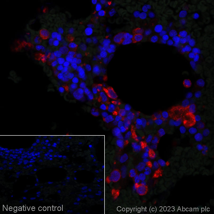 Immunohistochemistry (Formalin/PFA-fixed paraffin-embedded sections) - Alexa Fluor® 647 Anti-CD42b antibody [SP219] (AB314946), expandable thumbnail
