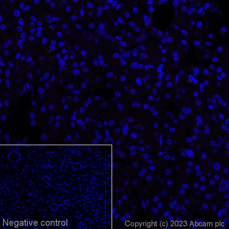Immunohistochemistry (Formalin/PFA-fixed paraffin-embedded sections) - Alexa Fluor® 647 Anti-CD42b antibody [SP219] (AB314946), expandable thumbnail
