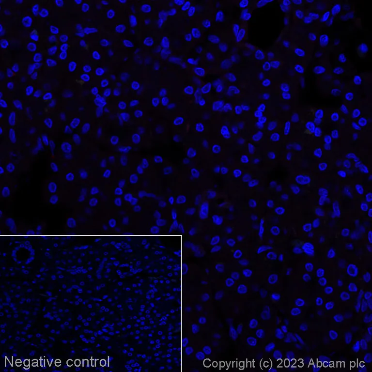 Immunohistochemistry (Formalin/PFA-fixed paraffin-embedded sections) - Alexa Fluor® 647 Anti-CD42b antibody [SP219] (AB314946)