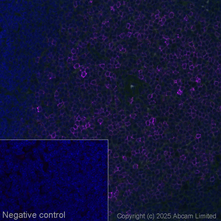 Immunohistochemistry (Formalin/PFA-fixed paraffin-embedded sections) - Alexa Fluor® 647 Anti-CD43 antibody [EPR28619-85] (AB325093)