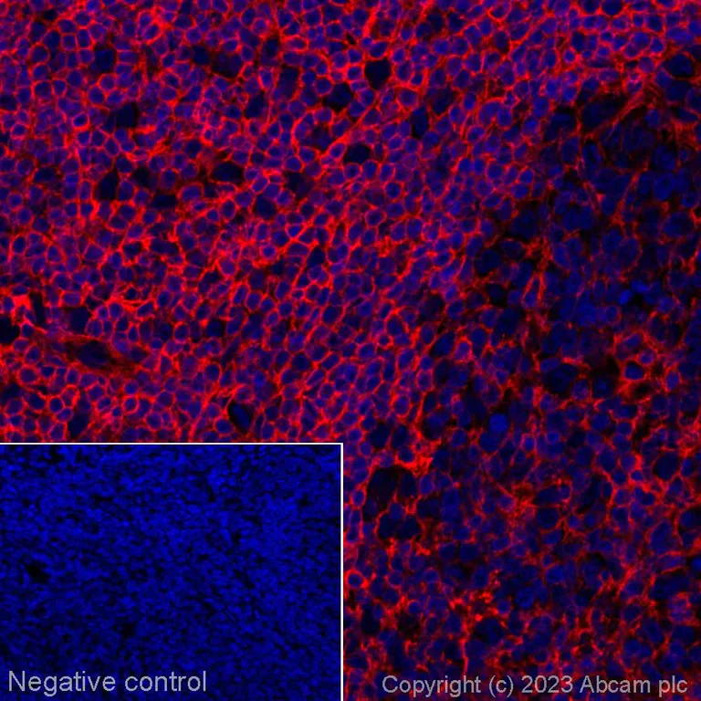 Immunohistochemistry (Formalin/PFA-fixed paraffin-embedded sections) - Alexa Fluor® 647 Anti-CD44 antibody [EPR18668] (AB314280)