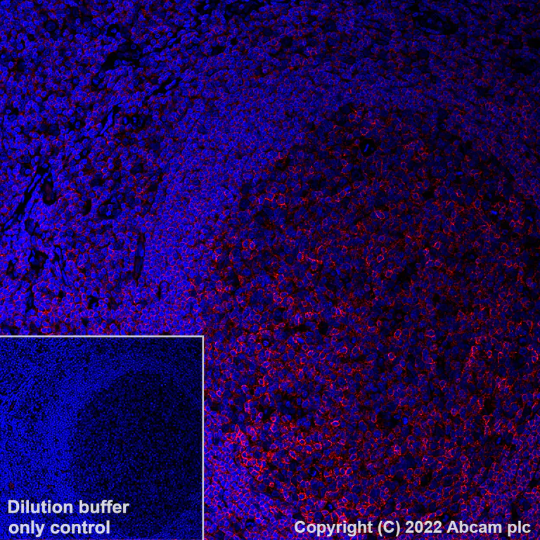 Immunohistochemistry (Formalin/PFA-fixed paraffin-embedded sections) - Alexa Fluor® 647 Anti-CD45 antibody [EPR20033] (AB305209)