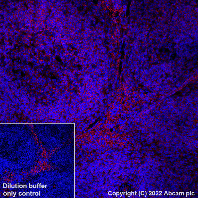 Immunohistochemistry (Formalin/PFA-fixed paraffin-embedded sections) - Alexa Fluor® 647 Anti-CD45 antibody [EPR20033] (AB305209)