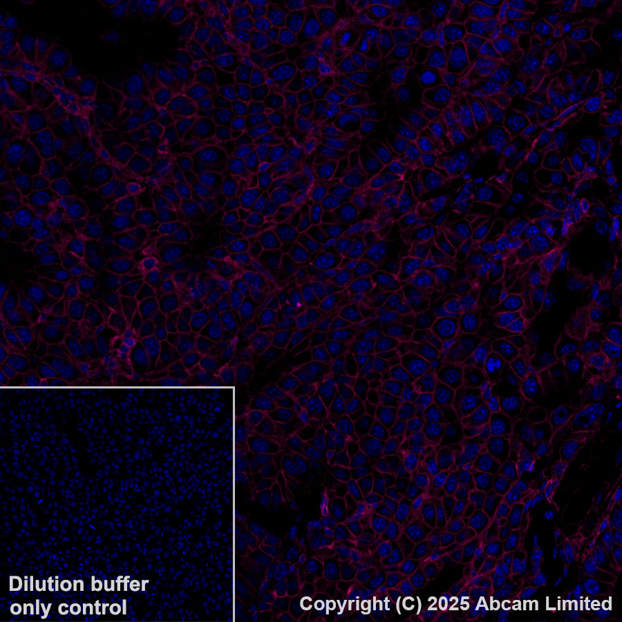 Immunohistochemistry (Formalin/PFA-fixed paraffin-embedded sections) - Alexa Fluor® 647 Anti-CD47 antibody [EPR28770-376] (AB323759), expandable thumbnail