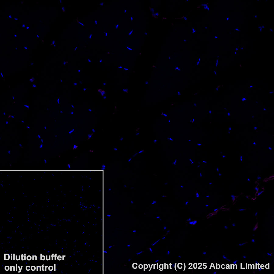 Immunohistochemistry (Formalin/PFA-fixed paraffin-embedded sections) - Alexa Fluor® 647 Anti-CD47 antibody [EPR28770-376] (AB323759), expandable thumbnail