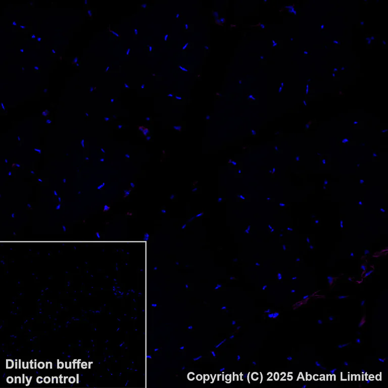 Immunohistochemistry (Formalin/PFA-fixed paraffin-embedded sections) - Alexa Fluor® 647 Anti-CD47 antibody [EPR28770-376] (AB323759)