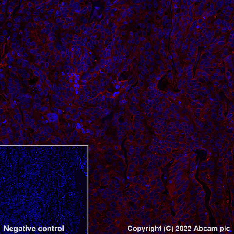Immunohistochemistry - Alexa Fluor® 647 Anti-CD47 antibody [SP279] (AB300096)