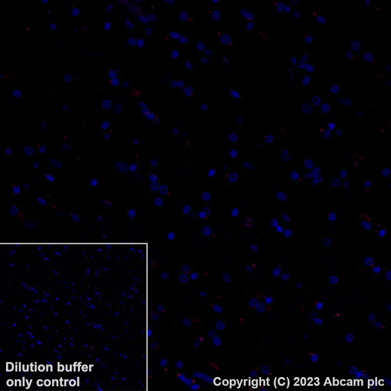 Immunohistochemistry (Formalin/PFA-fixed paraffin-embedded sections) - Alexa Fluor® 647 Anti-CD5 antibody [EP2952] (AB309505)