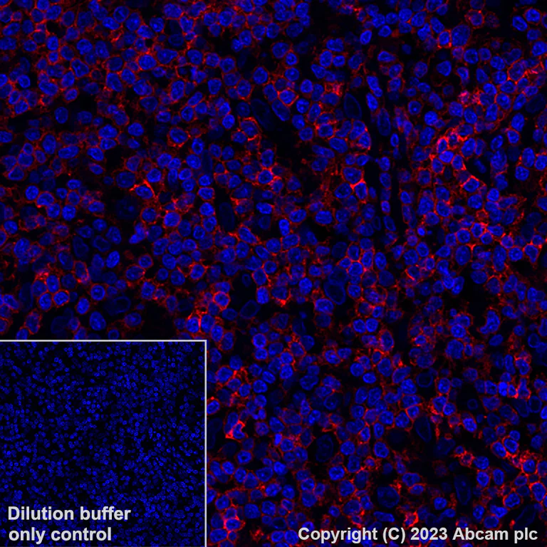Immunohistochemistry (Formalin/PFA-fixed paraffin-embedded sections) - Alexa Fluor® 647 Anti-CD5 antibody [EP2952] (AB309505)