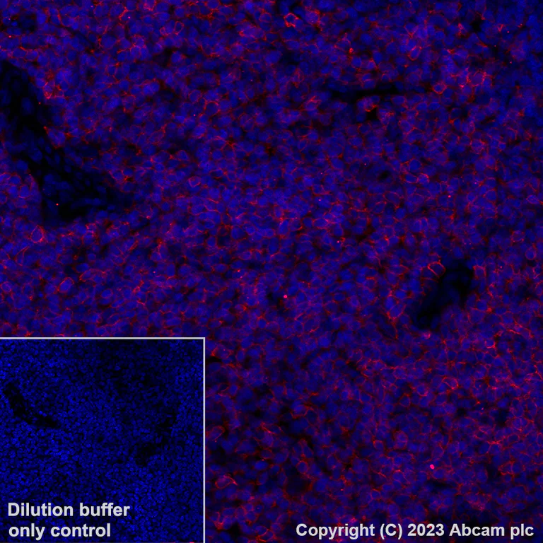 Immunohistochemistry (Formalin/PFA-fixed paraffin-embedded sections) - Alexa Fluor® 647 Anti-CD5 antibody [EPR26533-75] (AB314468)