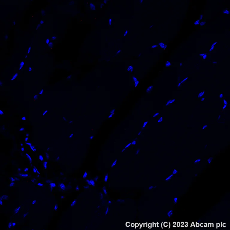 Immunohistochemistry (Formalin/PFA-fixed paraffin-embedded sections) - Alexa Fluor® 647 Anti-CD5 antibody [EPR26533-75] (AB314468)