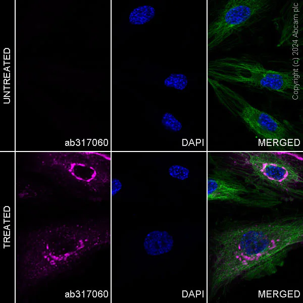 Immunocytochemistry/ Immunofluorescence - Alexa Fluor® 647 Anti-CD62E antibody [EPR25616-62] (AB317060)