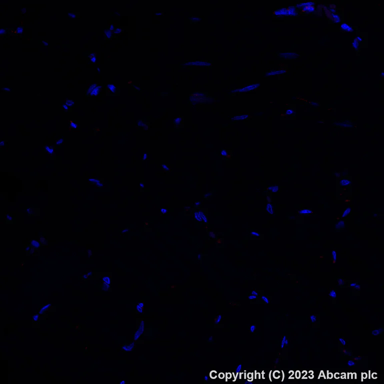 Immunohistochemistry (Formalin/PFA-fixed paraffin-embedded sections) - Alexa Fluor® 647 Anti-CD63 - Late Endosome Marker antibody [EPR5702] (AB309976)