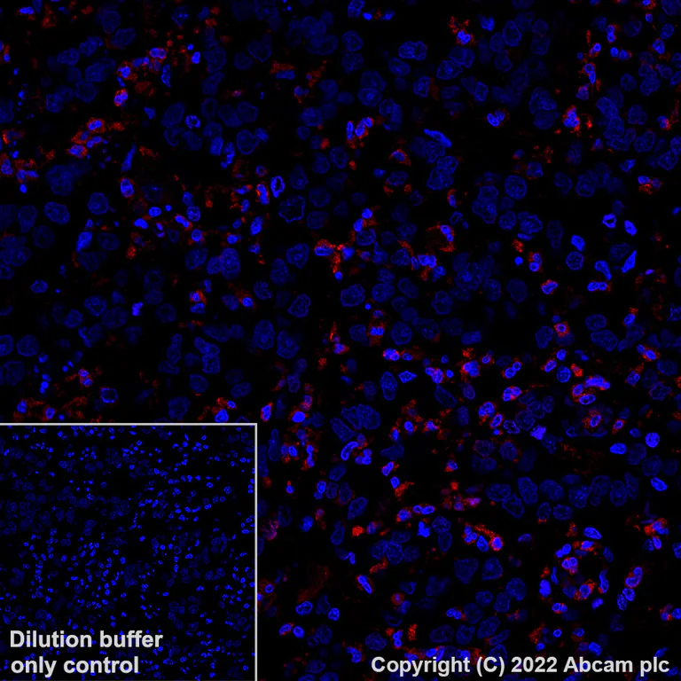 Immunohistochemistry (Formalin/PFA-fixed paraffin-embedded sections) - Alexa Fluor® 647 Anti-CD66b antibody [EPR25354-2] (AB307405)