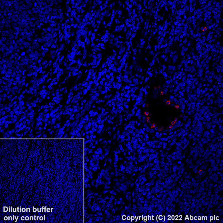 Immunohistochemistry (Formalin/PFA-fixed paraffin-embedded sections) - Alexa Fluor® 647 Anti-CD66b antibody [EPR25354-2] (AB307405)