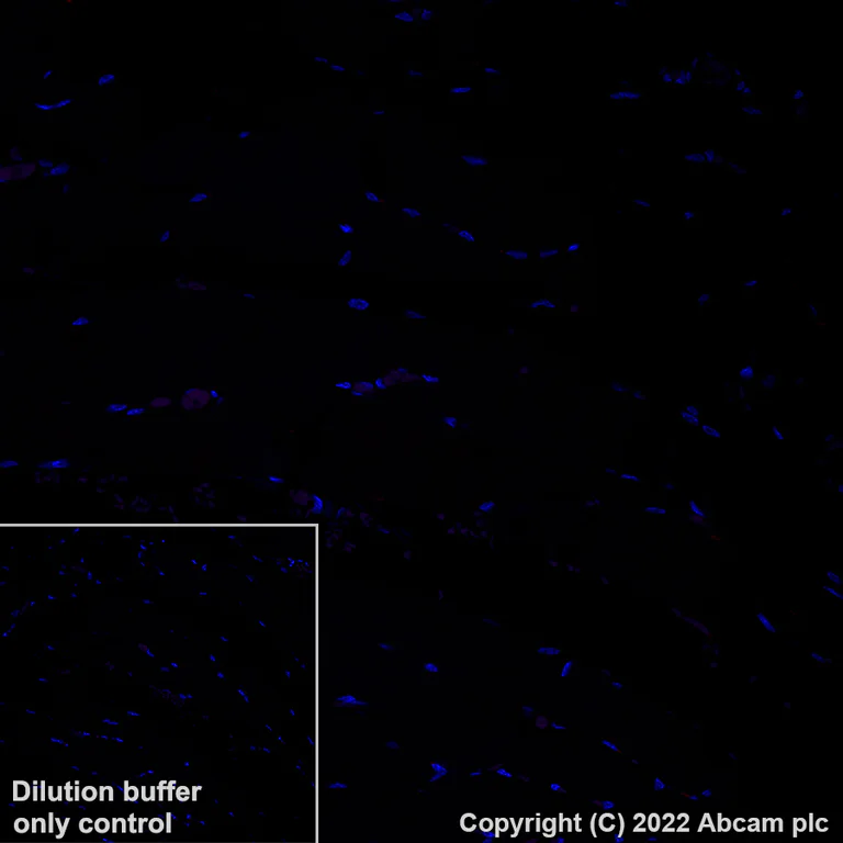 Immunohistochemistry (Formalin/PFA-fixed paraffin-embedded sections) - Alexa Fluor® 647 Anti-CD66b antibody [EPR25354-2] (AB307405)