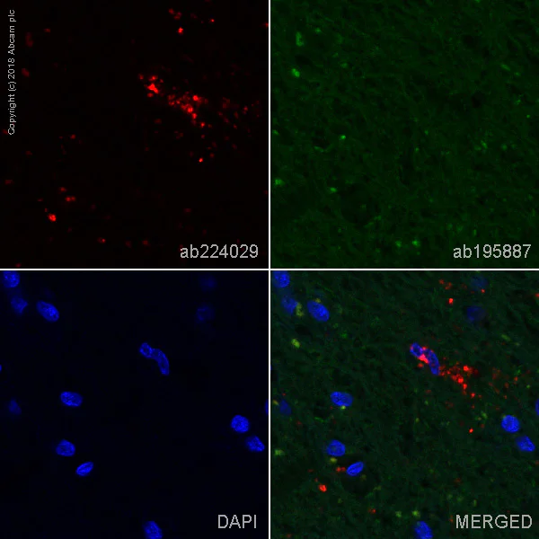 Immunohistochemistry (Formalin/PFA-fixed paraffin-embedded sections) - Alexa Fluor® 647 Anti-CD68 antibody [EPR20545] (AB224029)