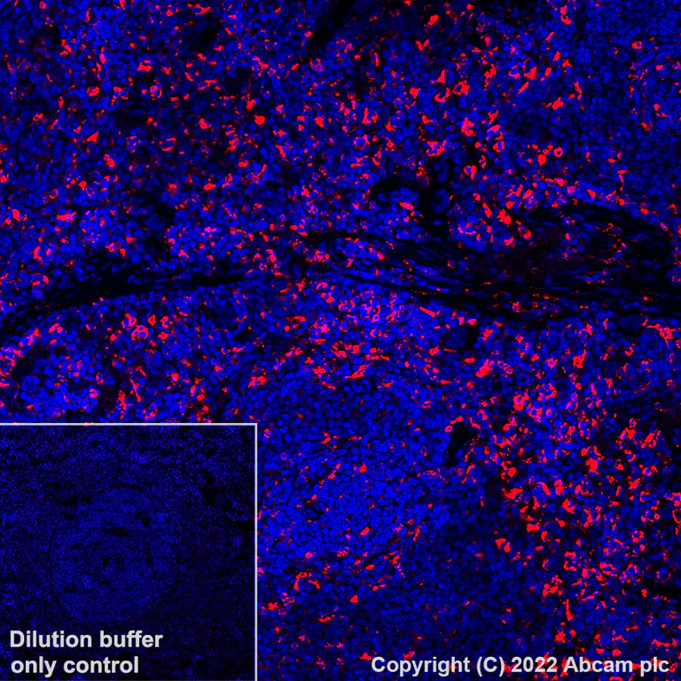 Immunohistochemistry (Formalin/PFA-fixed paraffin-embedded sections) - Alexa Fluor® 647 Anti-CD68 antibody [EPR23917-164] (AB305214)