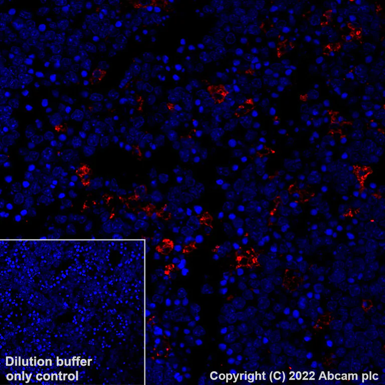 Immunohistochemistry (Formalin/PFA-fixed paraffin-embedded sections) - Alexa Fluor® 647 Anti-CD68 antibody [EPR23917-164] (AB305214)